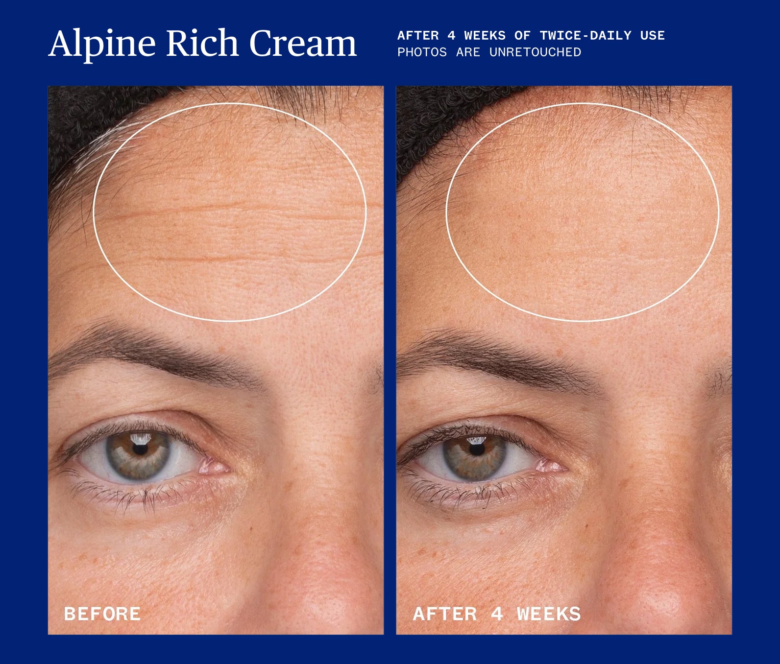 Before and after comparison of Alpine Rich Cream on a person's face, showing markedly diminished fine lines after 4 weeks of twice-daily use, with a blue border.