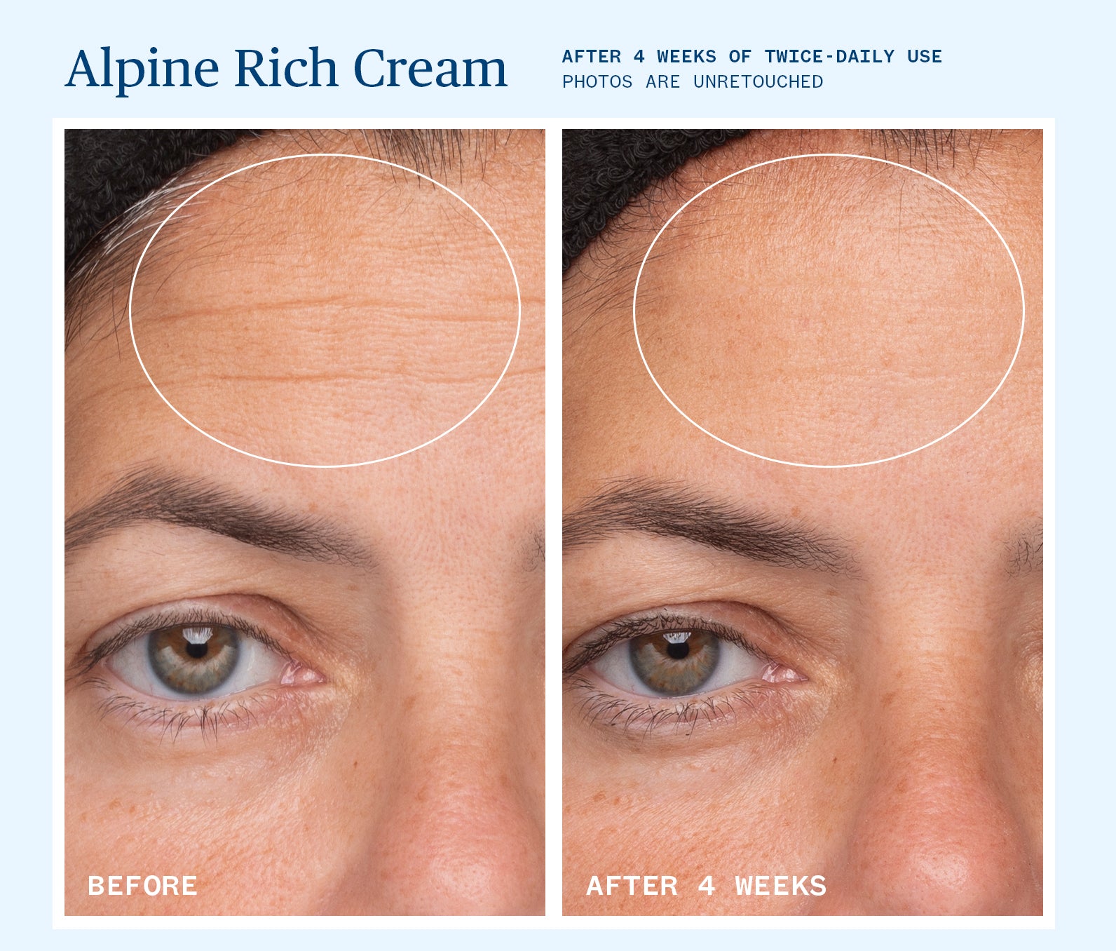 Alpine Rich Cream Before & After after 4 weeks