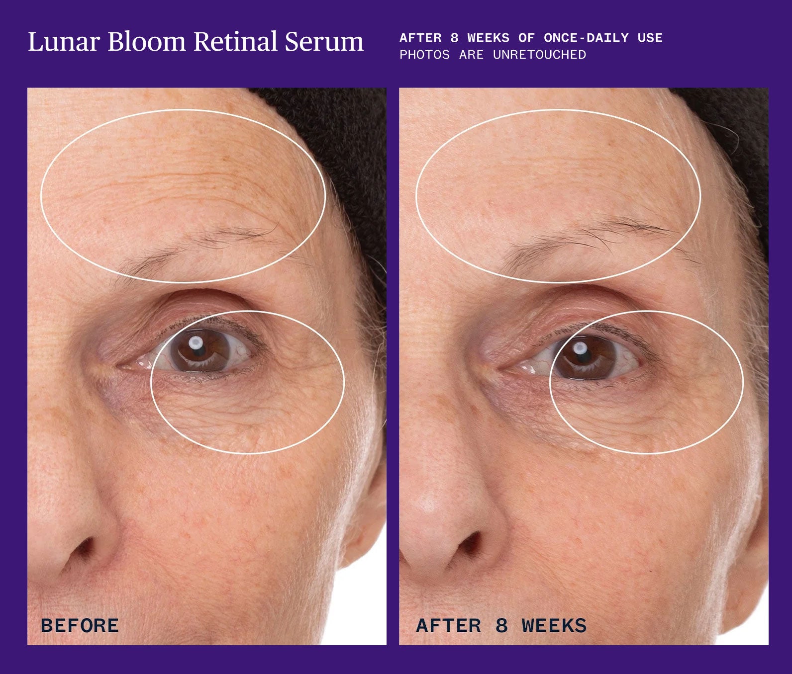 Lunar Bloom Retinal Serum - view 8